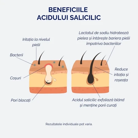 Suero de ácido salicílico 2%, para pieles sensibles y acneicas, 30 ml, Meloni