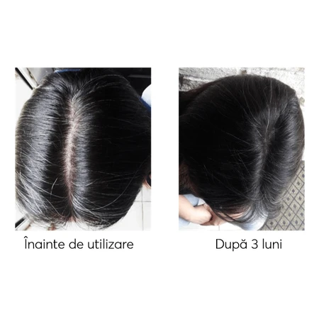 Kit contra la caída del cabello, Ageless Clinic, 3 piezas, Ru:t hair, 80 ml, Biocart