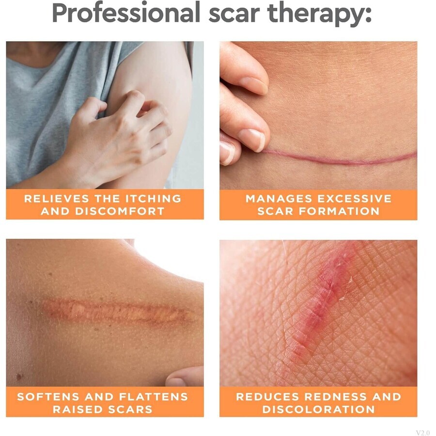 Strataderm Scar Treatment Gel, 20 g, Meditrina Pharmaceuticals