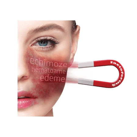 Kelapher crema para hematomas y contusiones con nano-lactoferrina 15 %, 50 ml