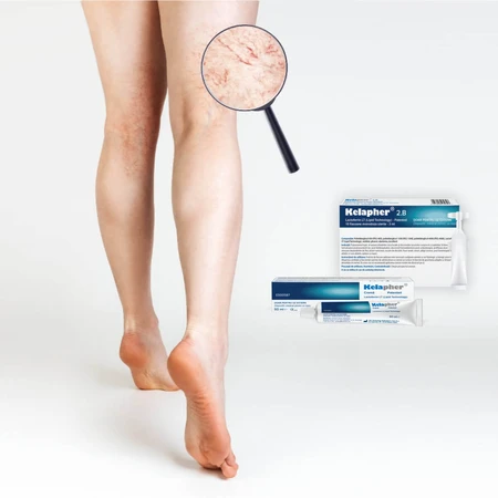 Kelapher crema para hematomas y contusiones con nano-lactoferrina 15 %, 50 ml