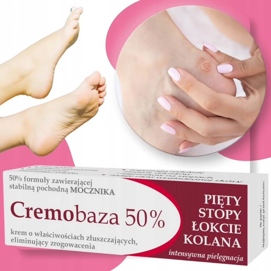 Cremobase 50 %, Peelingcreme gegen Keratosen, 30 g