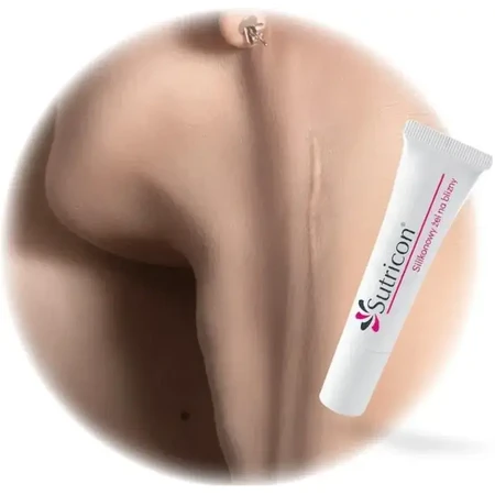 Sutricon, Silikon Gel für Narben, 15 ml