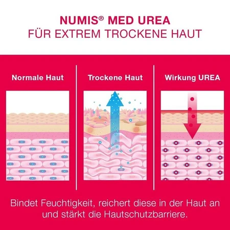 Ureum Body Lotion 5%, 300 ml, Numismed