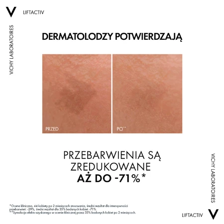 Vichy Liftactiv Specialist B3, sérum reductor de decoloración y arrugas, 30 ml