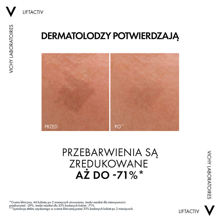 Vichy Liftactiv Specialist B3, serum to reduce discoloration and wrinkles, 30 ml