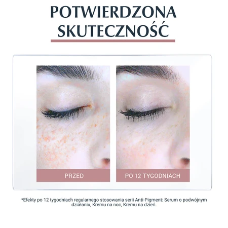 Eucerin Anti-Pigment, crème de jour pour les imperfections avec Thiamidol, SPF 30, 50 ml
