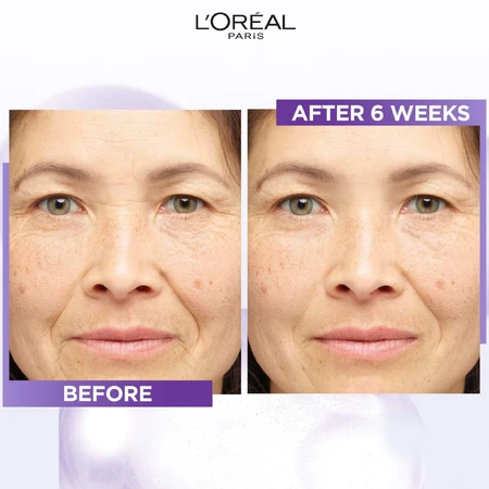 L'Oréal Paris Revitalift Filler Anti-rimpelserum met 1,5% puur hyaluronzuur 30 ml