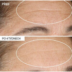 StriVectin Advanced Retinol Nacht Verjongende Crème 30 ml StriVectin Advanced Retinol Nacht Verjongende Crème 30 ml