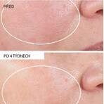 StriVectin Advanced Retinol Nacht Verjongende Crème 30 ml StriVectin Advanced Retinol Nacht Verjongende Crème 30 ml