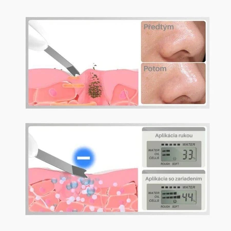 TouchBeauty 1887 Espátula facial ultrasónica