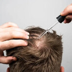 Scandinavian Biolabs® Bio-Pilixin® Activation serum om haaruitval te vertragen en haargroei te bevorderen voor mannen 100 ml