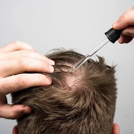 Scandinavian Biolabs® Bio-Pilixin® Activation Serum para frenar la caída del cabello y favorecer el crecimiento capilar en hombres, 100 ml
