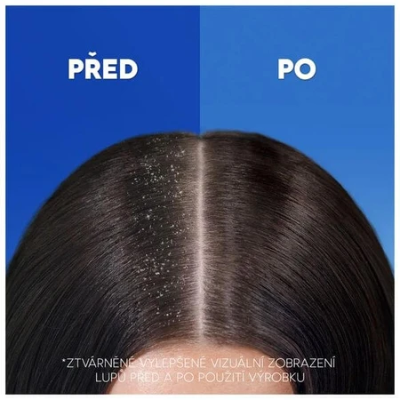 Head & Shoulders Anti-Hair Fall Caffeine Anti-Dandruff Shampooing 400 ml
