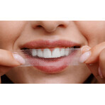 hello coco Bandes de blanchiment des dents PAP+ (bandes de blanchiment des dents) 28 pcs