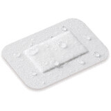 Lohmann & Rauscher Curapor transparante wondbedekker 10x8 cm steriel, waterbestendig 5 stuks