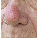 SIB COUPELIAC Day Cream 1×50 ml, cream