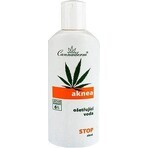 Cannaderm AKNEA treatment water 1×200 ml, acne treatment water Cannaderm AKNEA treatment water 1×200 ml, acne treatment water