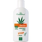 Cannaderm AKNEA treatment water 1×200 ml, acne treatment water Cannaderm AKNEA treatment water 1×200 ml, acne treatment water