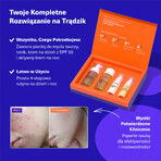 Vitumisil Kit Anti-Acné, espuma facial 100 ml + tónico 100 ml + crema de día 50 ml + crema de noche 50 ml Vitumisil Kit Anti-Acné, espuma facial 100 ml + tónico 100 ml + crema de día 50 ml + crema de noche 50 ml