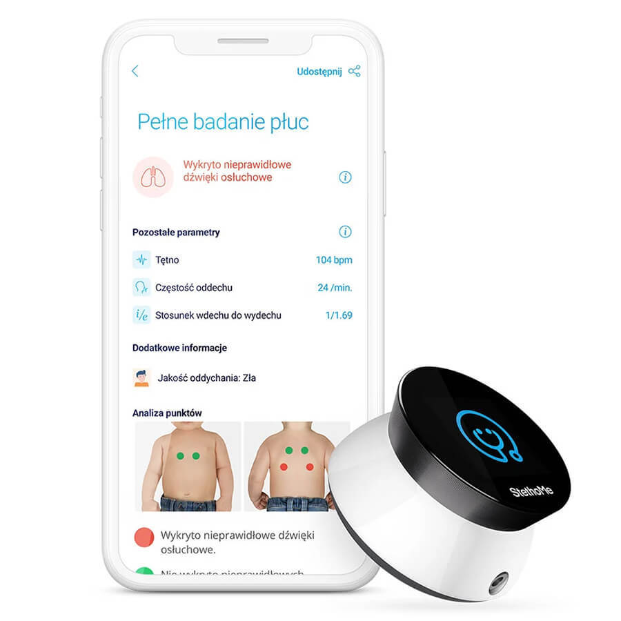 StethoMe, the smart stethoscope for the whole family