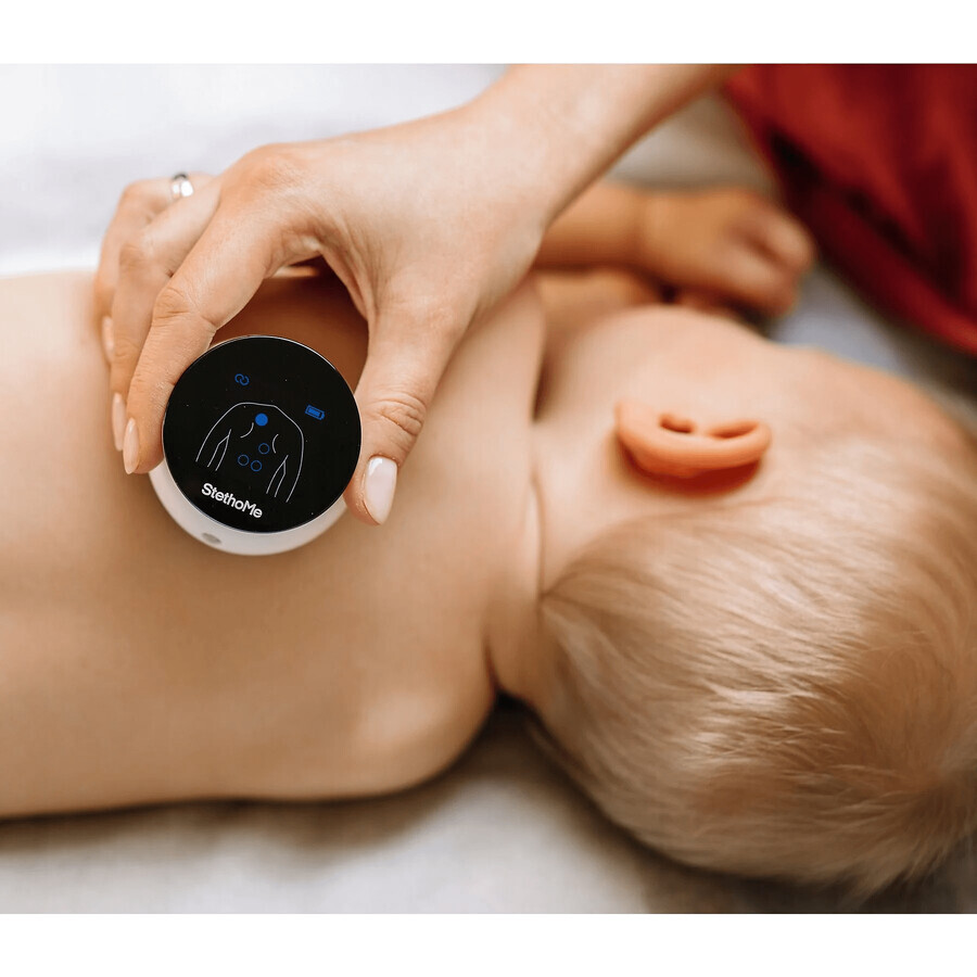 StethoMe, the smart stethoscope for the whole family