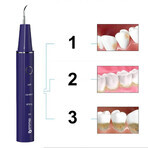Oromed Oro-Scal Dent, detartrant dentar cu ultrasunete Oromed Oro-Scal Dent, detartrant dentar cu ultrasunete