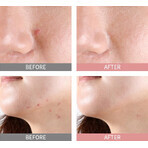 Mizon Good Bye Blemish Pink Spot, sérum en poudre anti-acné 19 ml