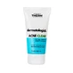 Acne Clear Dermatólogo Acne Clear Dermatólogo Crema Antiacné, 50 ml, Synergy Therm