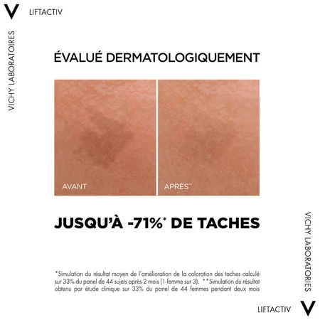 Vichy Liftactiv Anti-Falten Korrekturserum B3 30ml