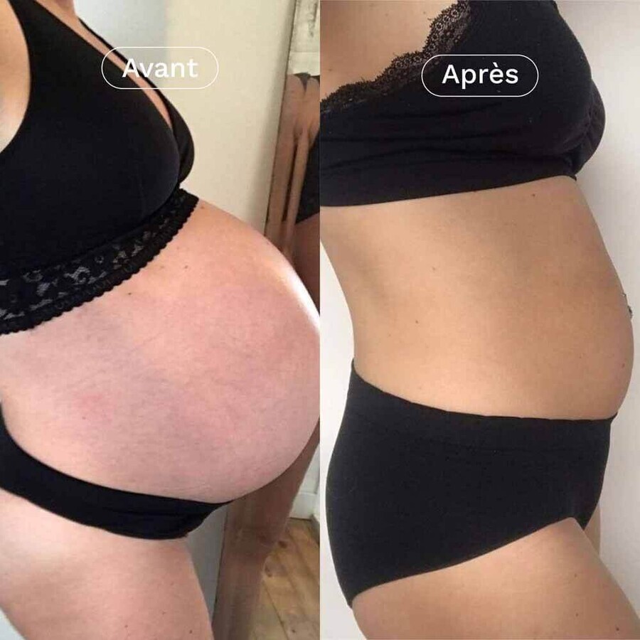Omum Duo In&Out Stretch Marks I gifted