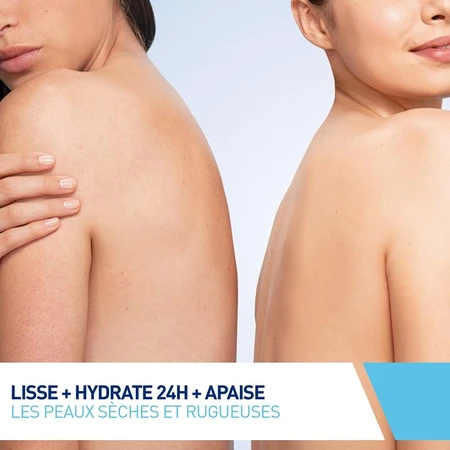 Cerave Body SA Gladmakende Crème 10% Urea en Salicylzuur Droge Huid 177ml