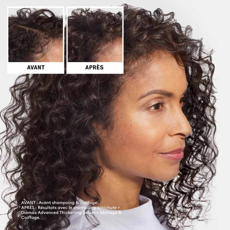 Nioxin Champú Anticaída Sandalore 240 ml