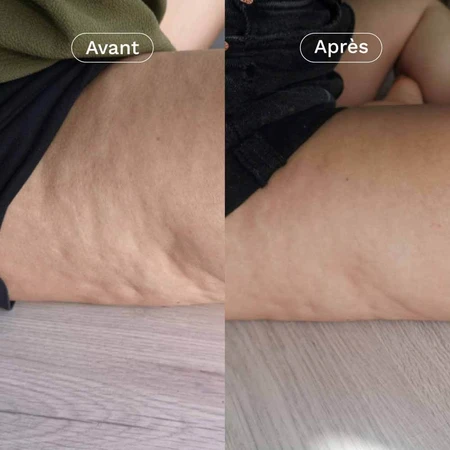 Omum De Coach Les Nutricosmétiques Afslanken en Verstevigen 60 Capsules