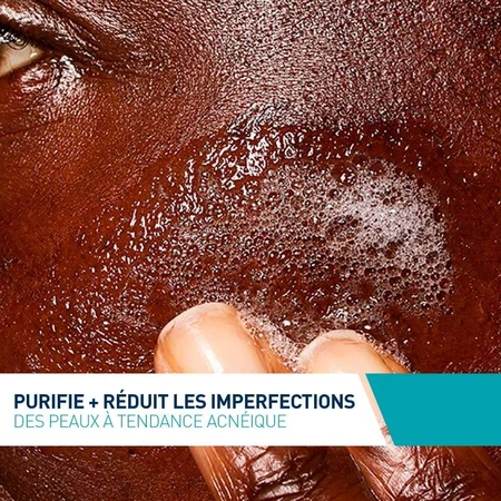 Cerave Espuma Limpiadora Facial Pieles con imperfecciones y propensas al acné 236ml