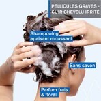 Uriage D.S Shampooing Traitant Keratoreducteur Hair 150 ml Uriage D.S Shampooing Traitant Keratoreducteur Hair 150 ml