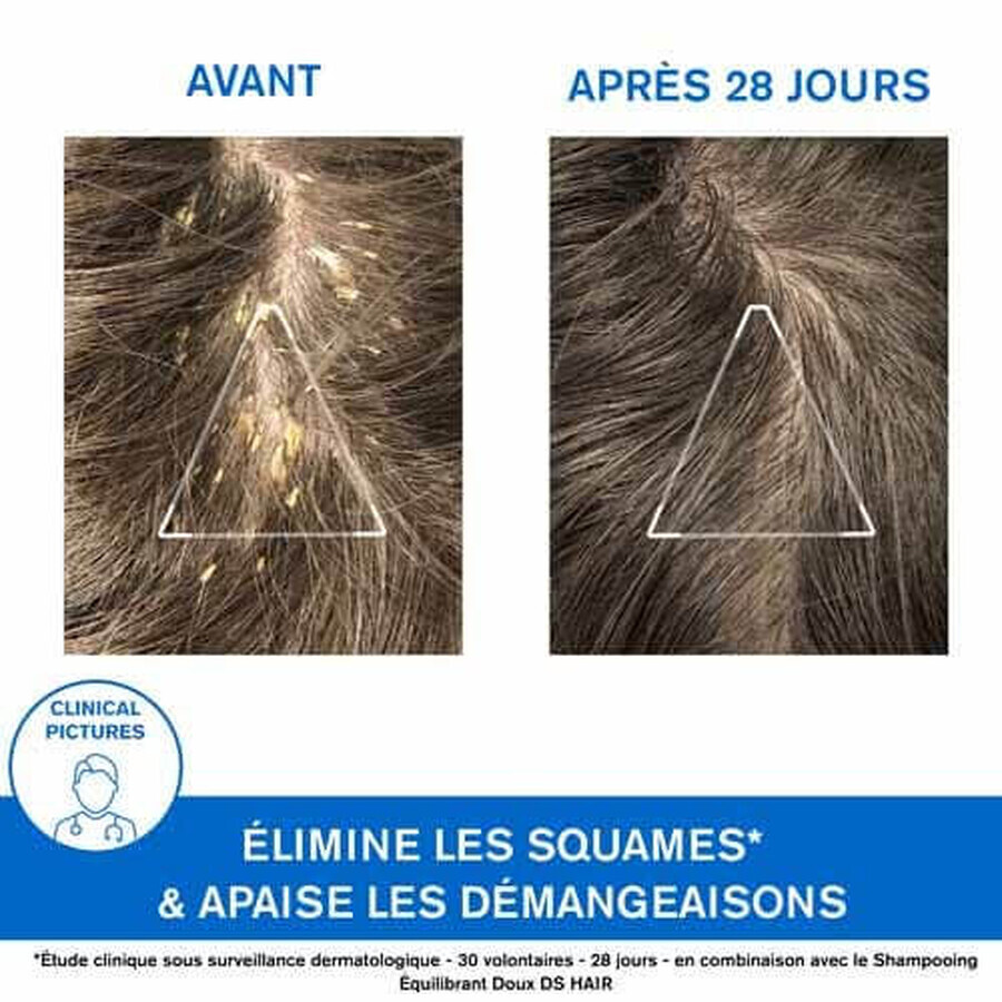 Uriage D.S Shampooing Traitant Keratoreducteur Hair 150 ml