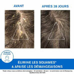 Uriage D.S Shampooing Traitant Keratoreducteur Hair 150 ml Uriage D.S Shampooing Traitant Keratoreducteur Hair 150 ml