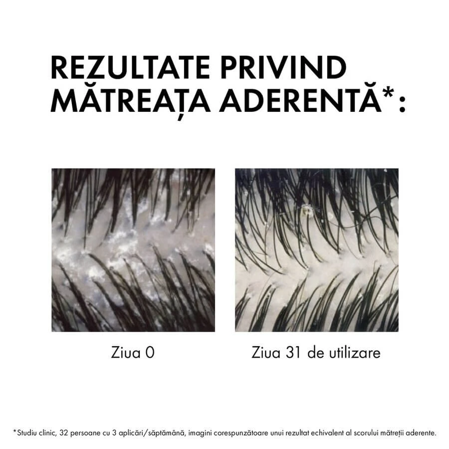 Rezerva eco sampon anti-matreata pentru par normal-gras Dercos, 390 ml, Vichy