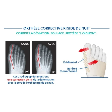 Ortesis Epitact para la corrección nocturna del hallux valgus x1