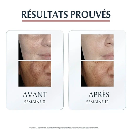 Eucerin Anti-Pigment Serum Duo 30ml