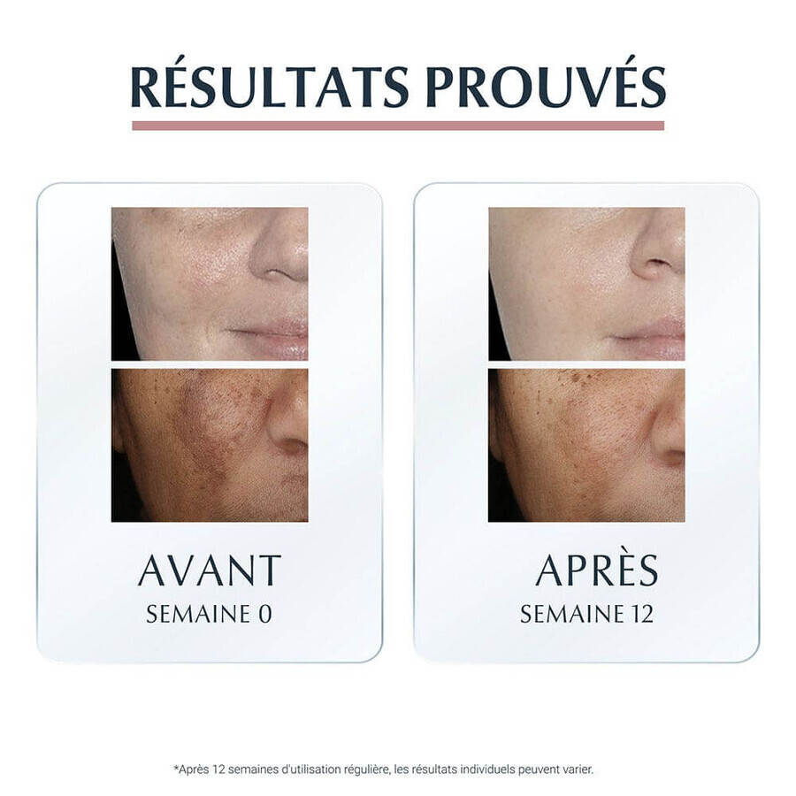 Eucerin Anti-Pigment Serum Duo 30ml
