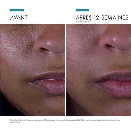 Skinceuticals Silymarin CF Serum Facial Anti-imperfecciones 30ml