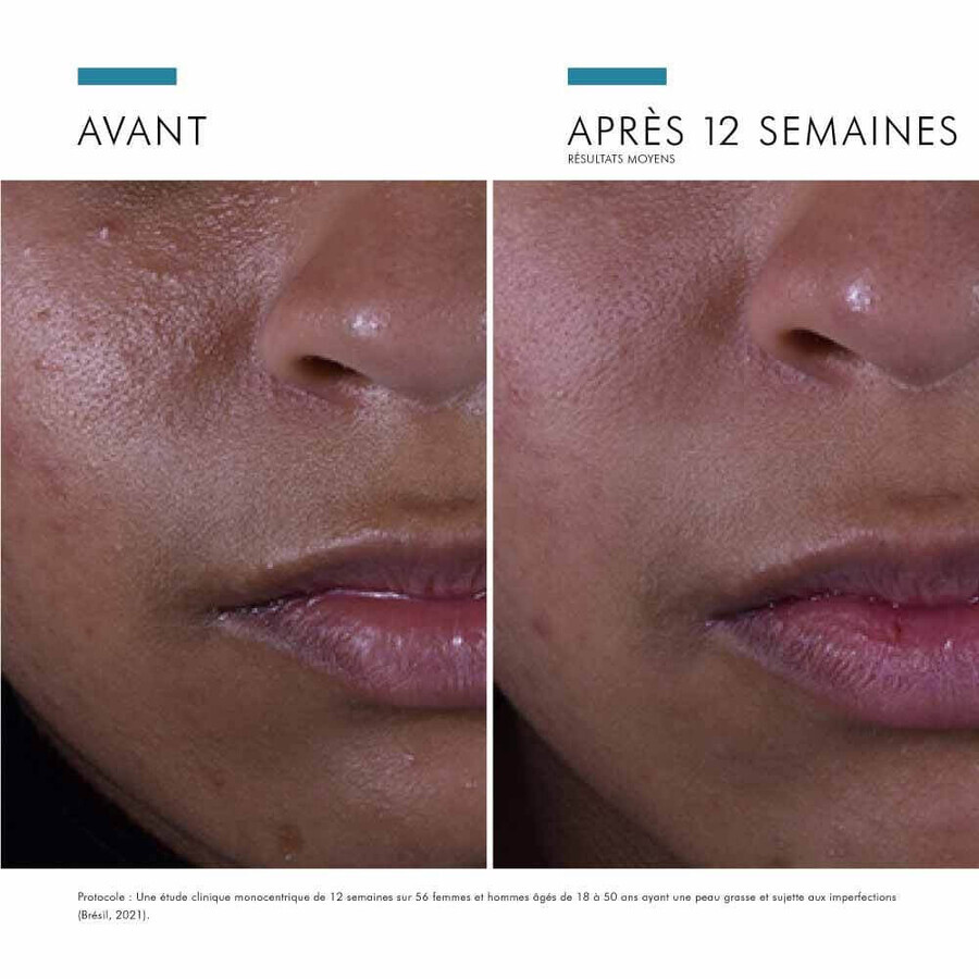 Skinceuticals Silymarin CF Anti-Unvollkommenheit Gesichtsserum 30ml