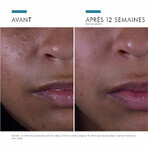 Skinceuticals Silymarin CF Anti-Unvollkommenheit Gesichtsserum 30ml Skinceuticals Silymarin CF Anti-Unvollkommenheit Gesichtsserum 30ml