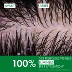 Șampon anti-mătreață pentru păr normal-gras Dercos, 390 ml, Vichy