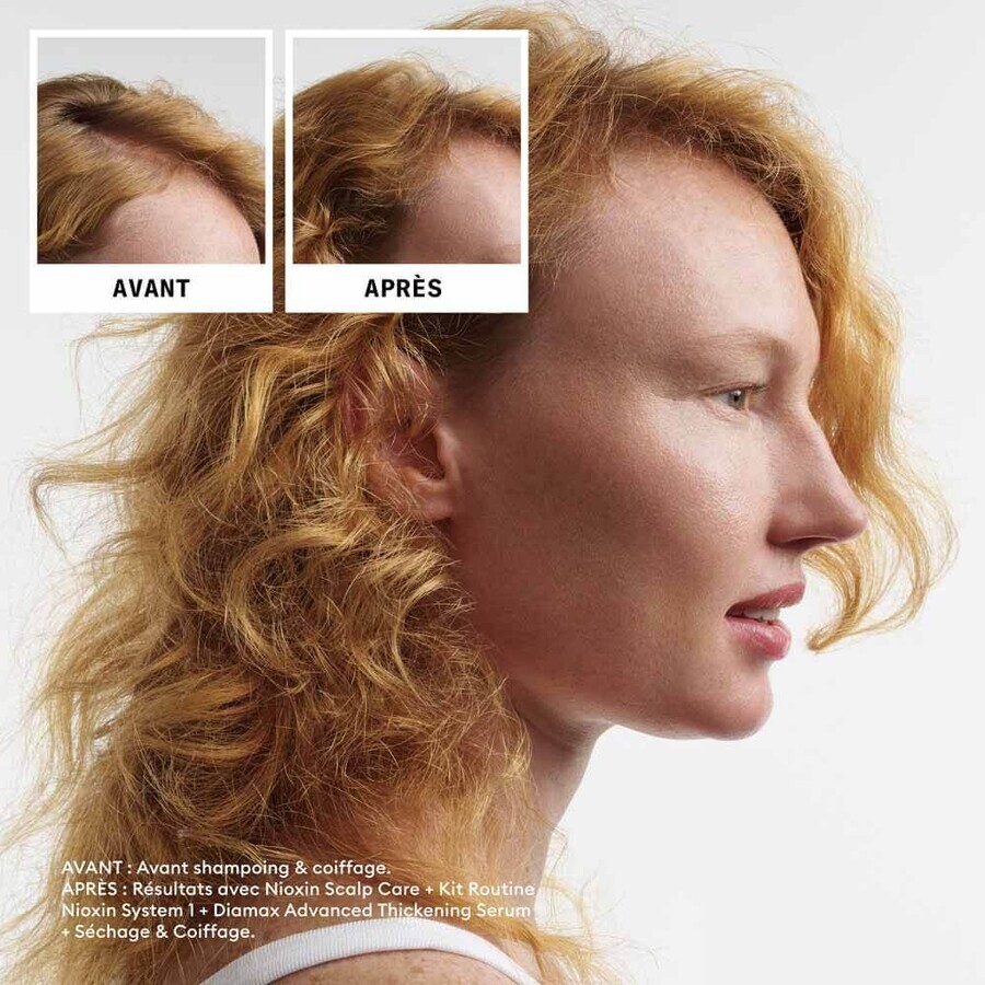 Nioxin System 1 Natural Hair Loss and Moderate Hair Loss Kit 700ml