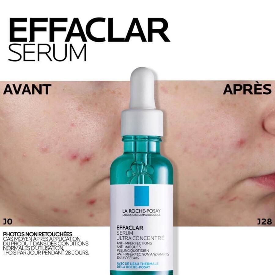 La Roche-Posay Effaclar Anti-Imperfection Face Serum Acne-prone Skin 30ml La Roche-Posay Effaclar Anti-Imperfection Face Serum Acne-prone Skin 30ml