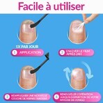 Excilor Traitement de la mycose de l'ongle Forte 30ml Excilor Traitement de la mycose de l'ongle Forte 30ml