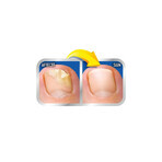 Scholl 2in1 Nagelpilzlösung 3,8 ml Applikator + 5 Feilen